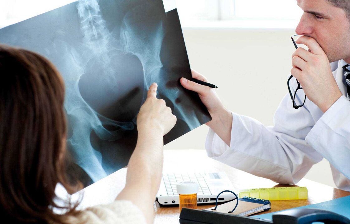 medicii care examinează cu raze X pentru artroza șoldului