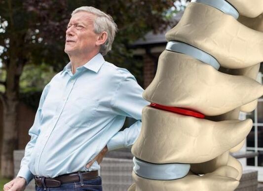 Osteocondroza afectează discurile intervertebrale și provoacă dureri de spate